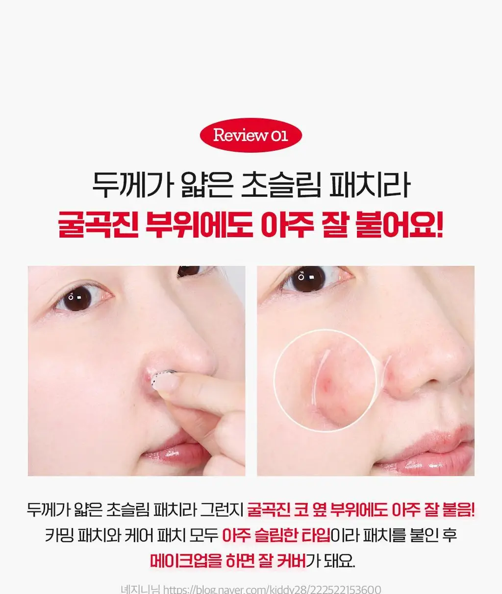[피부고민케어]아리얼 트루 AC 스팟 패치 듀오 세트 106매 상세페이지 25